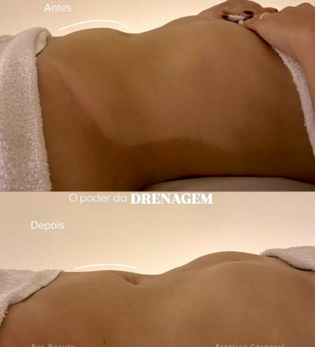 7 - drenagem antes e depois 1